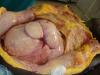 multilobular fibroid uterus